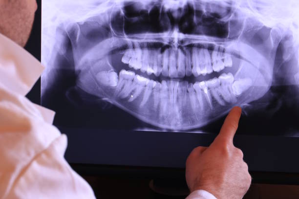 Best Emergency Dental Extractions in Levittown, PA